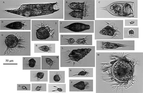  Heterotrichus: Un Ciliado con un Talento Oculto para la Filtración de Nutrientes!