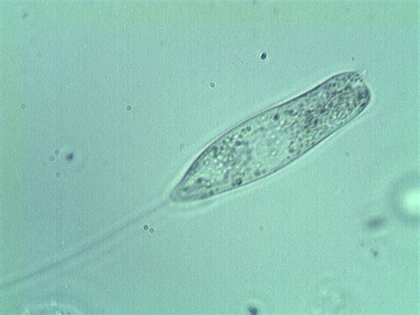  Chilodonella: ¡Un Microorganismo Flagelado Que Desafía Nuestra Percepción de la Vida Acuática!